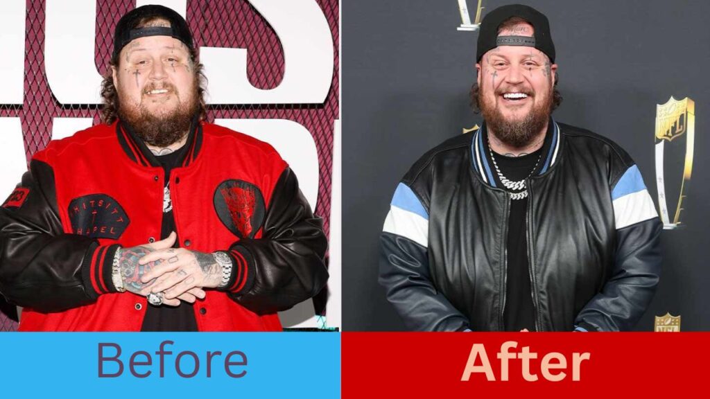 Jelly Roll's Weight Loss Journey: Shedding 200 Pounds In 2 Years, From 550 To 350 lbs — A Determined Fight For His Life